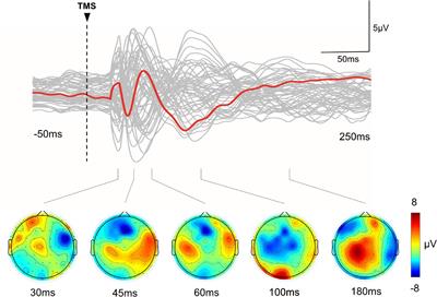 Intermittent Theta Burst Stimulation Increases Natural Oscillatory Frequency in Ipsilesional Motor Cortex Post-Stroke: A Transcranial Magnetic Stimulation and Electroencephalography Study